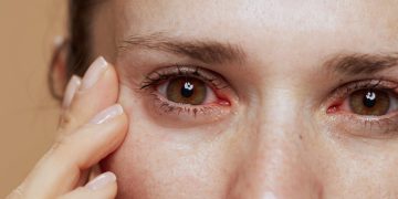 laserowa korekcja wzroku procedura 1770854306