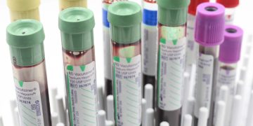 pielęgniarka w białym fartuchu pobierająca krew z ramienia pacjenta w gabinecie