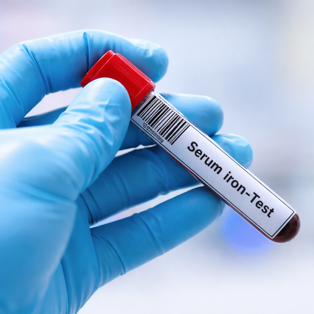 młoda kobieta krojąca szpinak i wątróbkę na desce kuchennej